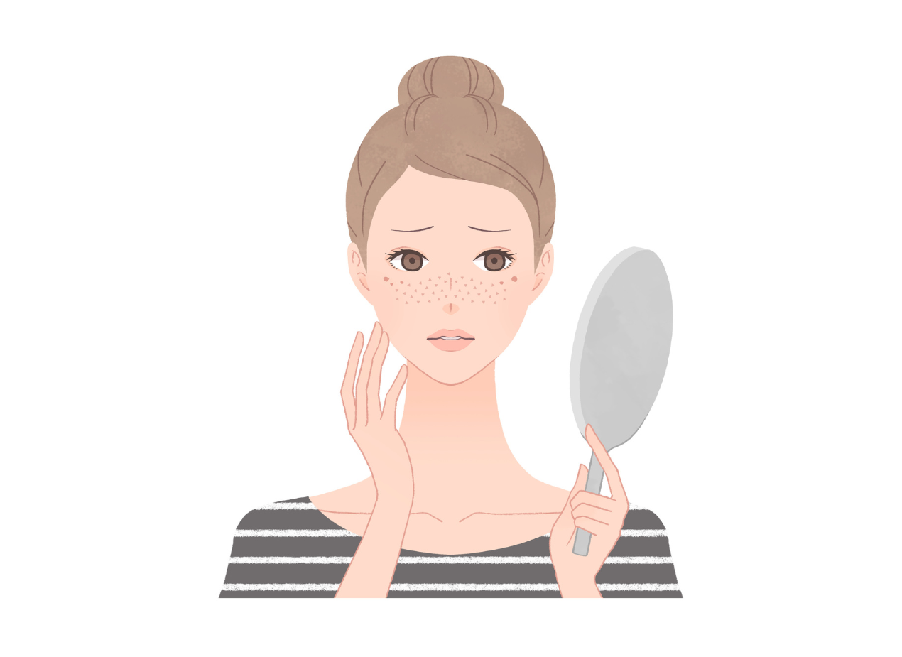 日焼け後のケア